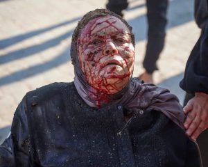 دماء على صدر البحر في غزة